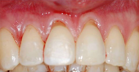 Norfolk Dental Specialists | Leading Specialists in Gum Disease